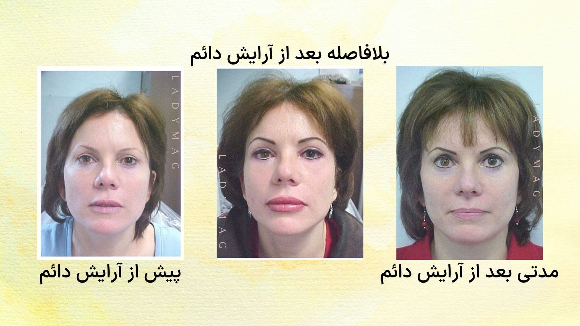 اجرا آرایش دائم در گذشته نه چندان دور